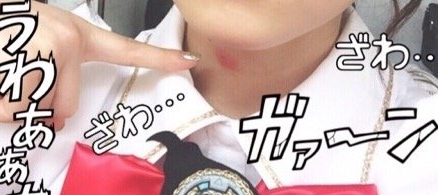 Akb48川栄李奈 キスマーク疑惑 Akbまとめるクン